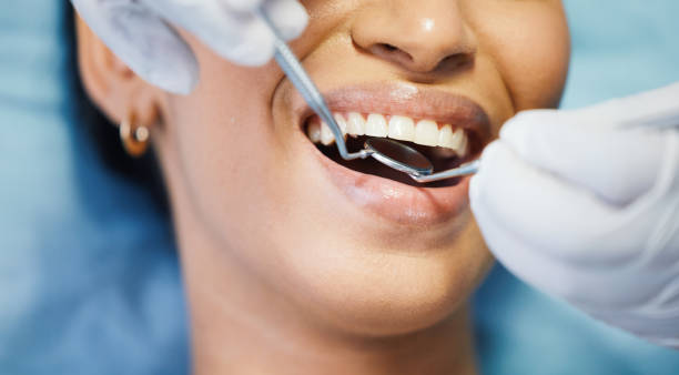 Best Emergency Dentist for Lost Fillings or Crowns in Zebulon, NC